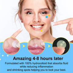 Acne Removal Pimple Patches