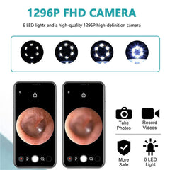 Earwax Removal Tool with Camera Ear Wax Cleaner Ear Picker Kit