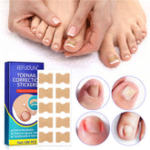 Ingrown Toenail Corrector Correction Patch Strips 100PCS
