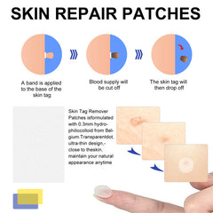 Wart or Skin Tag Remover Kit
