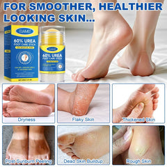 60% Urea Foot Balm Stick for Dry Cracked Heels - Intense Moisturising & Repair Care