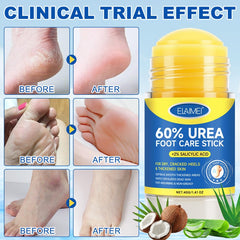 60% Urea Foot Balm Stick for Dry Cracked Heels - Intense Moisturising & Repair Care