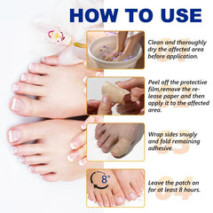 32 Pcs Nail Toenail Treatment Repair Patches Pads