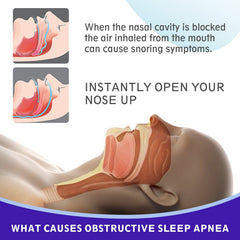 Anti-Snoring Devices Nasal-Strips for Breathing Nasal Congestion Relieve