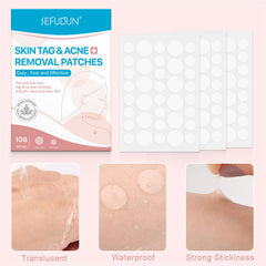 Natural Painless Auto Skin Tag Removal Kit Skin Tag Bands Remover Patches