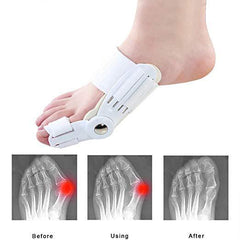 Big Toe Bunion Straightener Splint Corrector White