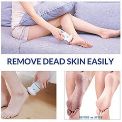 Electric Foot Callus Remover Grinder Pedicure Tools with Vacuum Removes Dead Skin