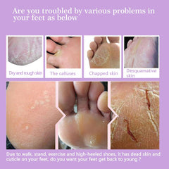 Exfoliating Peel Foot Mask Callus Hard Head Skin Remover