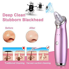 Electric Facial Blackhead Acne Suction Removal Pore Cleansing Vacuum