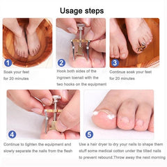 Ingrown Toenail Toe Fixer Recover Correction Device Pedicure Foot Nail Care Tool