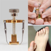 Ingrown Toenail Toe Fixer Recover Correction Device Pedicure Foot Nail Care Tool