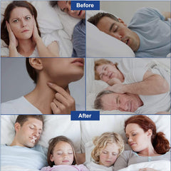 120 PCS Sleep Strips Mouth Tape Anti Snoring Devices