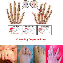 4pcs Toe Finger Straightener Separator Splint Hammer Hallux Valgus Corrector
