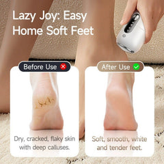 Electric Foot Callus Remover Portable Feet Grinder for Cracked Dry Heels Dead Skin Calluses