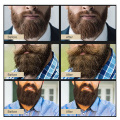 Beard Oil for Men – Softens & Moisturizes Beard Hair, Soothes Skin Irritation