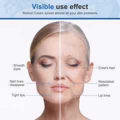 Face Cream Retinol Hyaluronic Acid Vitamin C Anti Aging Wrinkles Blemishes