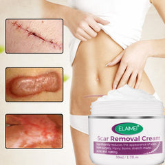 Scar Removal Cream New & Appearance of Old Scars Surgery, Stretch Marks, Acne