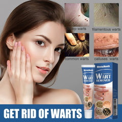 Wart Removal Body Warts Treatment Cream Foot Care Cream Skin Tag Remover