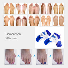 Bunion Splint Corrector Big Toe Straightener Brace Pad Blue & White