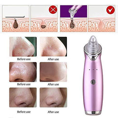 Electric Facial Blackhead Acne Suction Removal Pore Cleansing Vacuum