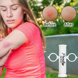 Painless Bug Bites Home Outdoor Extractor Mosquito After Vacuum Remover Suction Tool