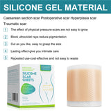 silicone gel sheets
