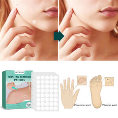 Skin Tag Removal Patches