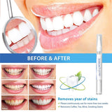 Teeth Whitening Oral Gel Polish Pen Hygiene Care Kits