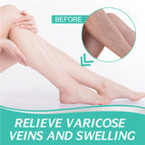 Varicose Veins Patch for Soothing Leg Fatigue Leg Pain Relief