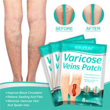 Varicose Veins Patch for Soothing Leg Fatigue Leg Pain Relief